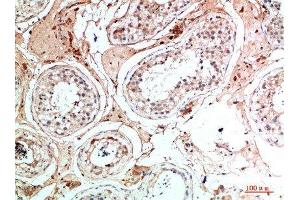 Immunohistochemical analysis of paraffin-embedded human-testis, antibody was diluted at 1:200 (Nanos Homolog 1 抗体  (AA 151-200))