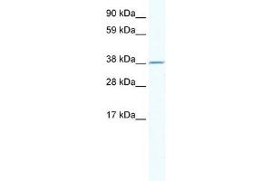 Human Thymus; WB Suggested Anti-RNF130 Antibody Titration: 2. (RNF130 抗体  (N-Term))