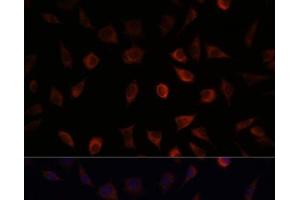 Immunofluorescence analysis of L929 cells using FABP1 Polyclonal Antibody at dilution of 1:100. (FABP1 抗体)