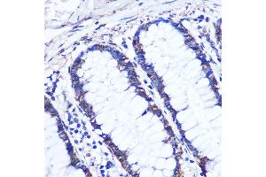 Immunohistochemistry of paraffin-embedded Human colon using OTUD7B Rabbit pAb (ABIN7269125) at dilution of 1:100 (40x lens). (OTUD7B 抗体  (AA 530-700))