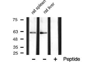 Western Blotting (WB) image for anti-Protein Kinase, AMP-Activated, alpha 1 Catalytic Subunit (PRKAA1) (pSer486) antibody (ABIN6255370)