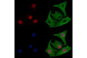 ABIN6264007 and ABIN6277984 staining Hela cells by IF/ICC. (Poly(A) Binding Protein, Cytoplasmic, Pseudogene 2 (PABPCP2) (C-Term) 抗体)