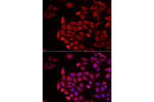 Immunofluorescence analysis of HeLa cells using COCH antibody (ABIN6132126, ABIN6138819, ABIN6138820 and ABIN6222234). (COCH 抗体  (AA 20-260))