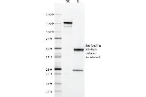SDS-PAGE Analysis Purified HLA-DQ Mouse Monoclonal Antibody (SPV-L3). (HLA DQ 抗体)