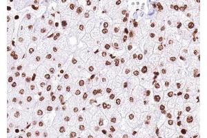 ABIN6272455 at 1/100 staining human liver tissue sections by IHC-P. (USP36 抗体)
