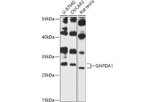 Western blot analysis of extracts of various cell lines, using GNPD antibody (3717) at 1:3000 dilution. (GNPDA1 抗体  (AA 1-70))