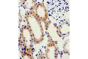 Immunohistochemistry (Paraffin-embedded Sections) (IHC (p)) image for anti-Adrenergic Receptor, alpha 1d (ADRA1D) (AA 1-30), (N-Term) antibody (ABIN1945085)