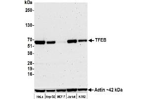Western Blotting (WB) image for anti-Transcription Factor EB (TFEB) (AA 426-476) antibody (ABIN7453326) (Recombinant TFEB 抗体  (AA 426-476))