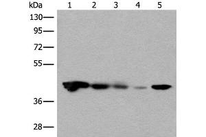 Western blot analysis of Jurkat HEPG2 and Hela cell Human testis tissue 231 cell lysates using CECR5 Polyclonal Antibody at dilution of 1:650 (CECR5 抗体)