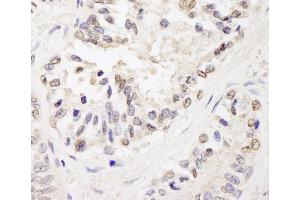 Immunohistochemistry (IHC) image for anti-Zinc Finger Protein, Multitype 1 (ZFPM1) (AA 175-225) antibody (ABIN7453709)