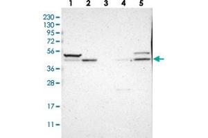 Western blot analysis of Lane 1: RT-4, Lane 2: U-251 MG, Lane 3: Human Plasma, Lane 4: Liver, Lane 5: Tonsil with SOX7 polyclonal antibody . (SOX7 抗体)
