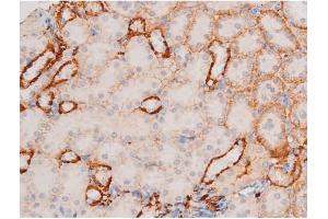 Immunohistochemistry (IHC) image for anti-X-Linked Inhibitor of Apoptosis (XIAP) (pSer87) antibody (ABIN6256441)