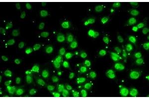 Immunofluorescence analysis of MCF7 cells using QKI Polyclonal Antibody (QKI 抗体)