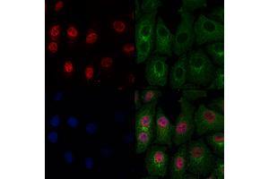 ABIN6263919 and ABIN6274026 staining Hela cells by IF/ICC. (OTX1 抗体  (Internal Region))