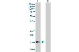 Western Blot analysis of GPLD1 expression in transfected 293T cell line by GPLD1 MaxPab polyclonal antibody. (GPLD1 抗体  (AA 1-176))