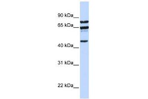PPP4R2 antibody used at 1 ug/ml to detect target protein. (PPP4R2 抗体  (C-Term))