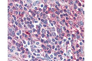 Anti-VIPR2 antibody IHC of human spleen. (VIPR2 抗体  (Internal Region))
