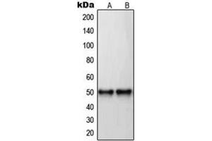 Western blot analysis of RAR beta expression in U87MG (A), MDAMB435 (B) whole cell lysates.