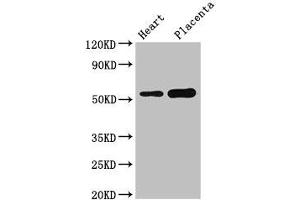 Western Blot Positive WB detected in: Mouse heart tissue, Human placenta tissue All lanes: DOK3 antibody at 3 μg/mL Secondary Goat polyclonal to rabbit IgG at 1/50000 dilution Predicted band size: 54, 24, 36, 25 kDa Observed band size: 54 kDa (DOK3 抗体  (AA 1-146))