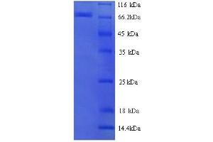 SDS-PAGE (SDS) image for Estrogen Receptor 1 (ESR1) (AA 10-595) protein (His tag) (ABIN7478954) (Estrogen Receptor alpha Protein (AA 10-595) (His tag))