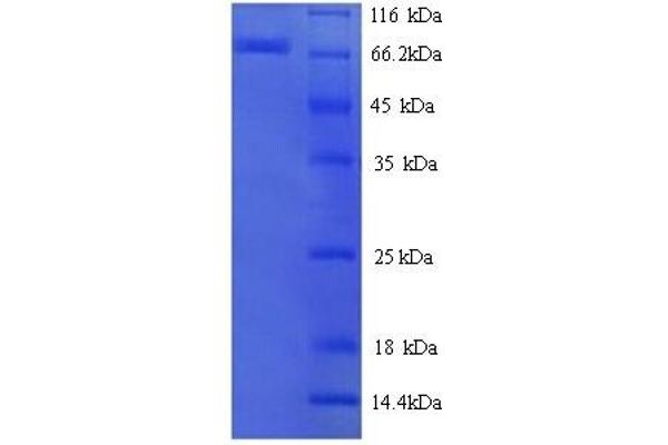 Estrogen Receptor alpha Protein (AA 10-595) (His tag)