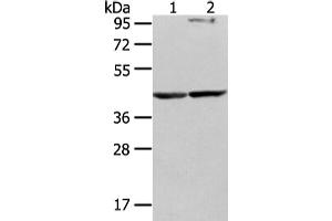 Western Blotting (WB) image for anti-WW Domain Containing Oxidoreductase (WWOX) antibody (ABIN5962023) (WWOX 抗体)