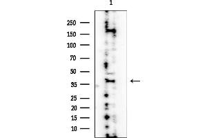 anti-N-Acetylglucosamine Kinase (NAGK) antibody