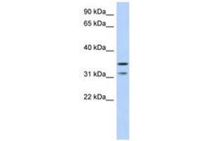 Image no. 1 for anti-Retinoic Acid Induced 12 (RAI12) (AA 143-192) antibody (ABIN6741255) (Retinoic Acid Induced 12 (RAI12) (AA 143-192) 抗体)