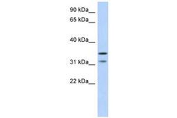 Retinoic Acid Induced 12 (RAI12) (AA 143-192) 抗体