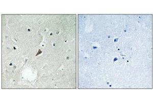 Immunohistochemical analysis of paraffin-embedded human brain tissue using PYK2 (Phospho-Tyr579) antibody (left)or the same antibody preincubated with blocking peptide (right).