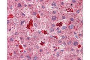 Immunohistochemistry (IHC) image for anti-Solute Carrier Family 8 (Sodium/calcium Exchanger), Member 3 (SLC8A3) (AA 144-193) antibody (ABIN768913)