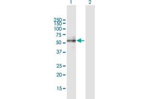 Western Blot analysis of BMP2 expression in transfected 293T cell line by BMP2 MaxPab polyclonal antibody. (BMP2 抗体  (AA 1-396))