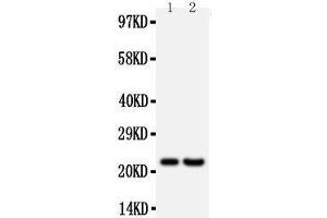 Anti-FGF9 antibody, Western blotting All lanes: Anti FGF9  at 0. (FGF9 抗体  (Middle Region))