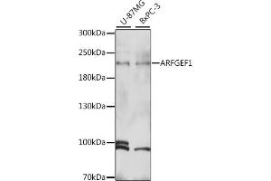 Western blot analysis of extracts of various cell lines, using  antibody (ABIN7265487) at 1:1000 dilution. (ARFGEF1 抗体  (AA 220-420))