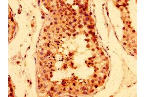 IHC image of ABIN7171496 diluted at 1:400 and staining in paraffin-embedded human testis tissue performed on a Leica BondTM system. (TNKS 抗体  (AA 35-130))