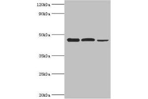 Western blot All lanes: Eukaryotic initiation factor 4A-I antibody at 3 μg/mL Lane 1: K562 whole cell lysate Lane 2: Hela whole cell lysate Lane 3: Rat brain tissue Secondary Goat polyclonal to rabbit IgG at 1/10000 dilution Predicted band size: 47, 40 kDa Observed band size: 47 kDa (EIF4A1 抗体  (AA 167-406))