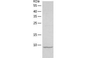 Western Blotting (WB) image for S100 Calcium Binding Protein A4 (S100A4) (AA 1-101) protein (His-IF2DI Tag) (ABIN7124957)