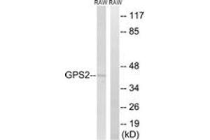 Western blot analysis of extracts from RAW264. (GPS2 抗体  (AA 11-60))