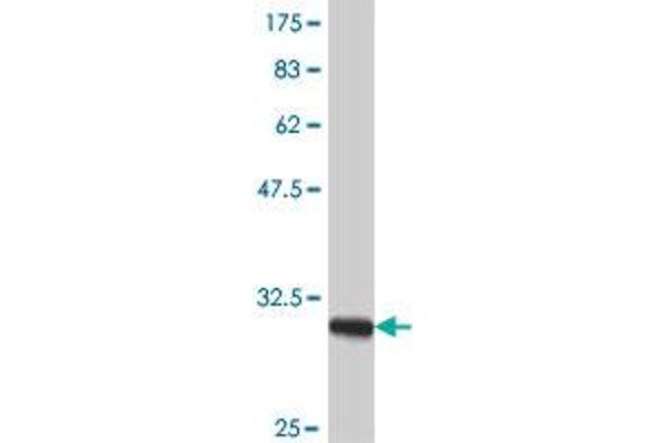 Mitochondrially Encoded NADH Dehydrogenase 4 (MT-ND4) (AA 406-459) 抗体