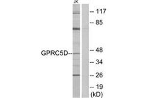 Western Blotting (WB) image for anti-G Protein-Coupled Receptor, Family C, Group 5, Member D (GPRC5D) (AA 271-320) antibody (ABIN2890864) (GPRC5D 抗体  (AA 271-320))