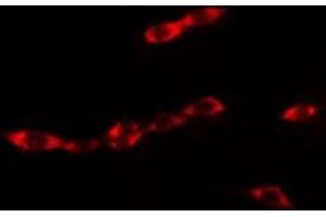 ABIN6275459 staining MCF7 cells by IF/ICC. (RAB18 抗体  (Internal Region))