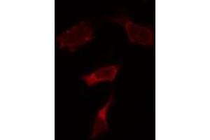 ABIN6274051 staining HepG2 by IF/ICC. (TLR9 抗体  (Internal Region))