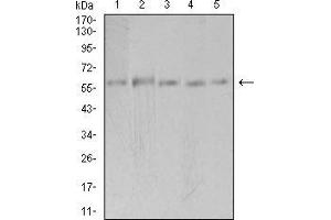 Western blot analysis using PAK3 mouse mAb against Hela (1), SK-N-SH (2), T47D (3), COS7 (4), and HepG2 (5) cell lysate. (PAK3 抗体  (AA 1-100))