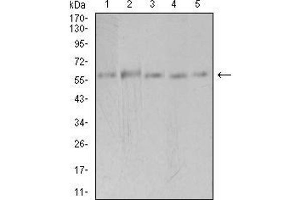 PAK3 抗体  (AA 1-100)