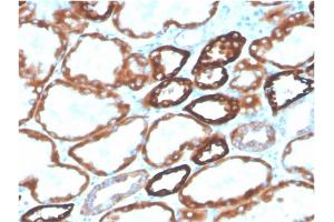 Formalin-fixed, paraffin-embedded human kidney stained with Biotin-conjugated CDH16Mouse Monoclonal Antibody (CDH16/2125). (Cadherin-16 抗体  (AA 371-507) (Biotin))