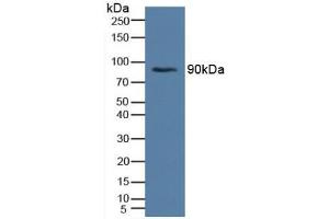 Western blot analysis of Human Serum. (Insulin Receptor 抗体  (AA 622-945))