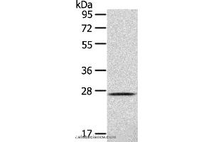 Western blot analysis of 293T cell , using CLEC4D Polyclonal Antibody at dilution of 1:123 (CLEC4D 抗体)