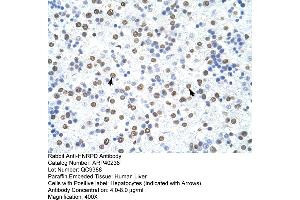 Rabbit Anti-HNRPD Antibody  Paraffin Embedded Tissue: Human Liver Cellular Data: Hepatocytes Antibody Concentration: 4. (HNRNPD/AUF1 抗体  (C-Term))