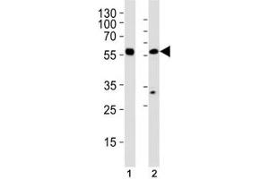 Western blot analysis of (1) HL-60 and (2) U251 MG cell line using p65 antibody at 1:1000.