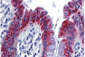 Human Colon: Formalin-Fixed, Paraffin-Embedded (FFPE) (AGR2 抗体  (AA 101-150))